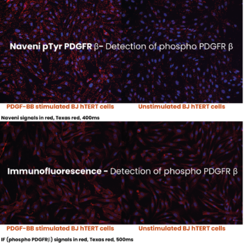 Naveni pTyr PDGFRβ comparison to Immunofluorescence (2)