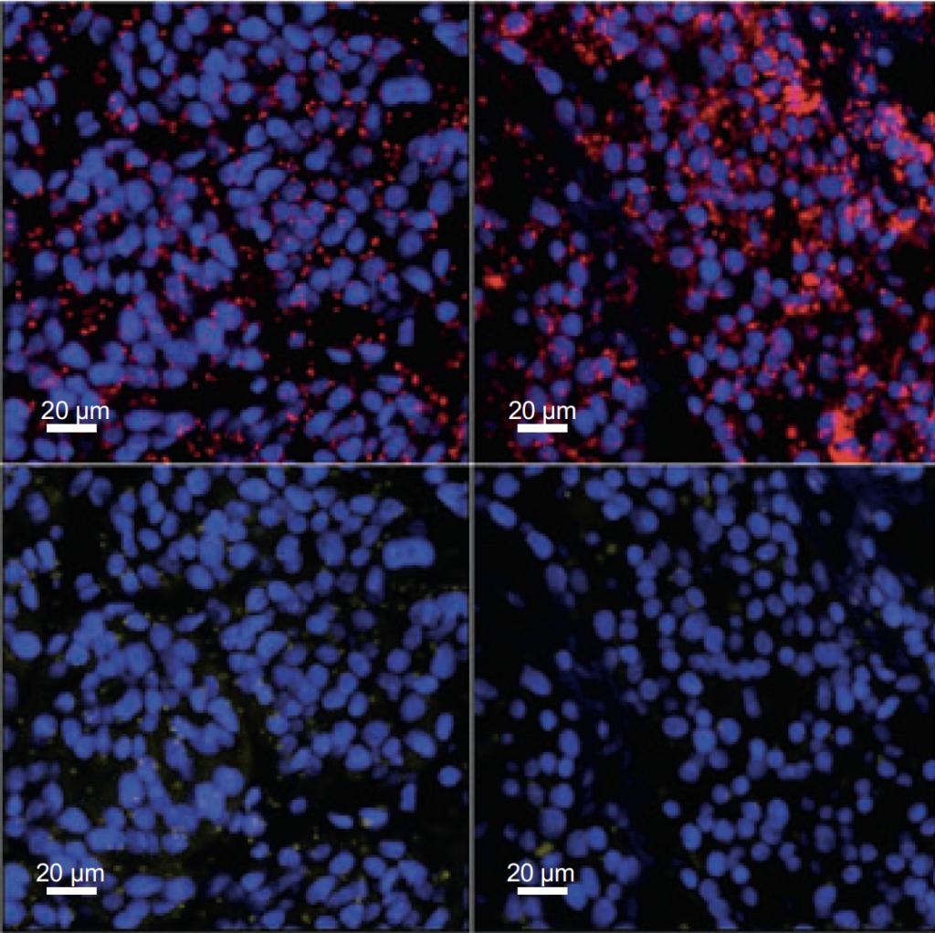 Navinci is pleased to highlight the publication of a new study in Nature Communications reporting findings from the ASTEROID Phase 1 clinical trial.