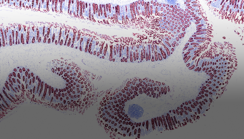 Navinci announces the launch of NaveniBright™ AUTO, extending its automated isPLA portfolio to open automated staining platforms.
